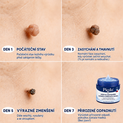 Ximonth® 7‑denní krém k odstraňování kožních výrůstků a pigmentových skvrn 🧴(𝐒𝐜𝐡𝐦𝐞𝐫𝐳𝐟𝐫𝐞𝐢𝐞 𝐅𝐨𝐫𝐦𝐞𝐥 – 𝐨𝐡𝐧𝐞 𝐍𝐚𝐫𝐛𝐞𝐧) 💜