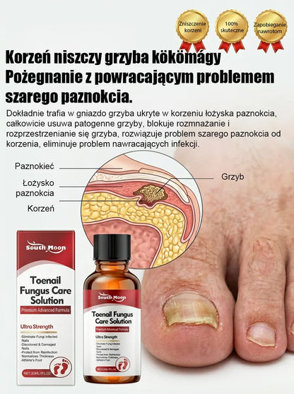 【Bezbolesna wymiana paznokci】Ziołowy łagodny płyn do naprawy paznokci dotkniętych grzybicą