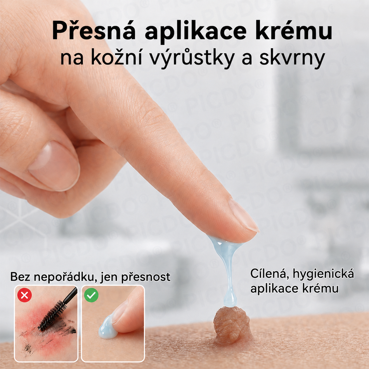 Ximonth® 7‑denní krém k odstraňování kožních výrůstků a pigmentových skvrn 🧴(𝐒𝐜𝐡𝐦𝐞𝐫𝐳𝐟𝐫𝐞𝐢𝐞 𝐅𝐨𝐫𝐦𝐞𝐥 – 𝐨𝐡𝐧𝐞 𝐍𝐚𝐫𝐛𝐞𝐧) 💜